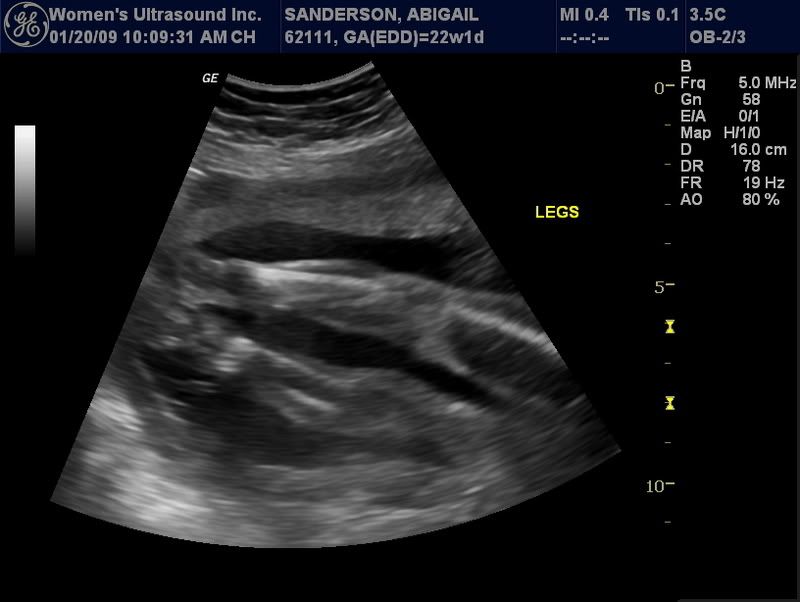 Legs Pictures, Images and Photos