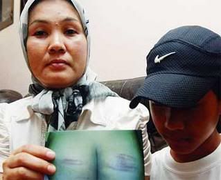 ANGRY: Narini Ya showing pictures of her son's wounds inflicted by his teacher.
